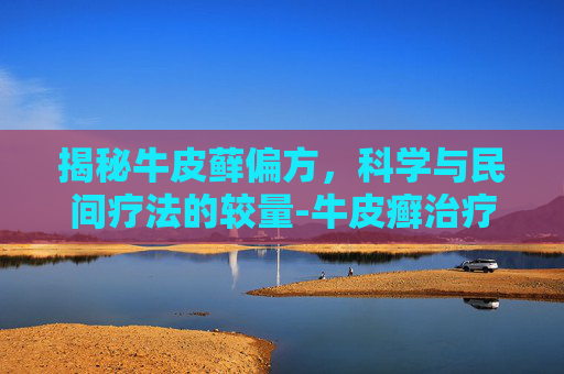 揭秘牛皮藓偏方，科学与民间疗法的较量-牛皮癣治疗偏方