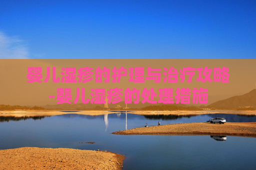 婴儿湿疹的护理与治疗攻略-婴儿湿疹的处理措施